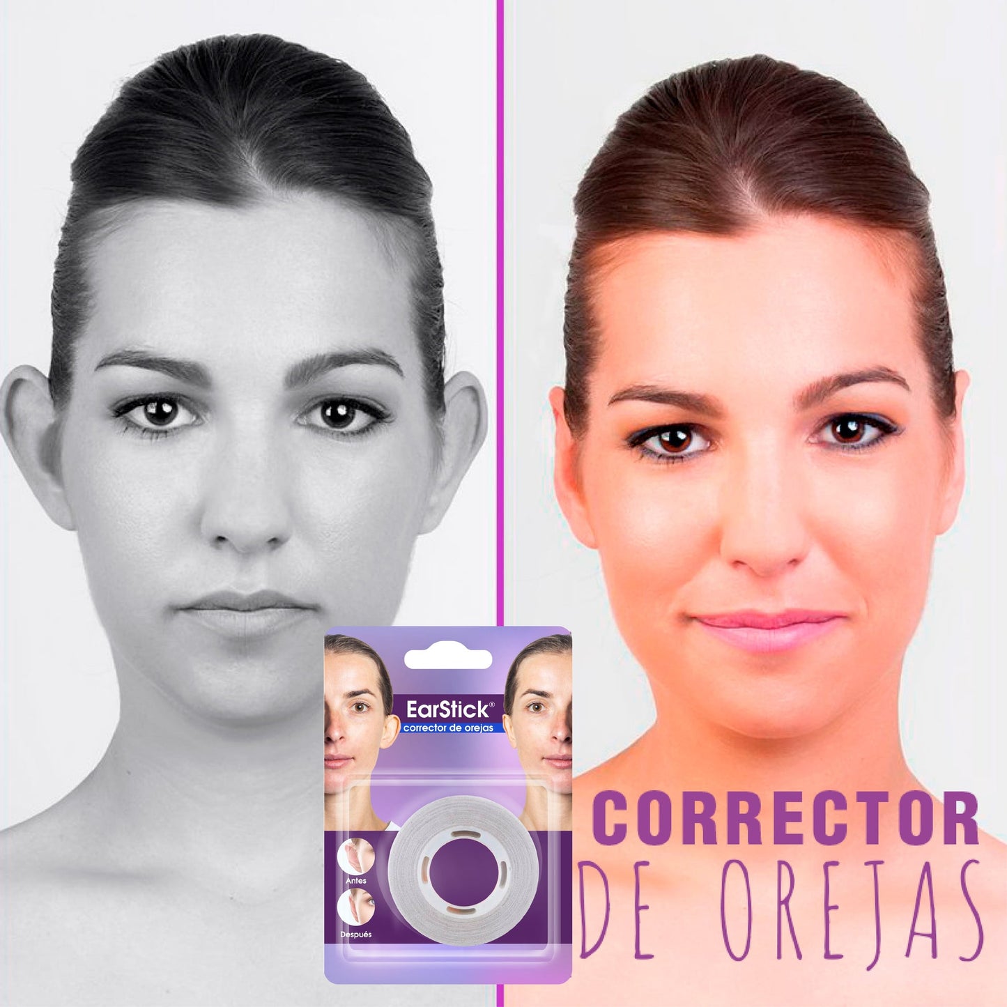 Corrector de Orejas + Guía de Ejercicios Profesionales Para Corregir las Orejas