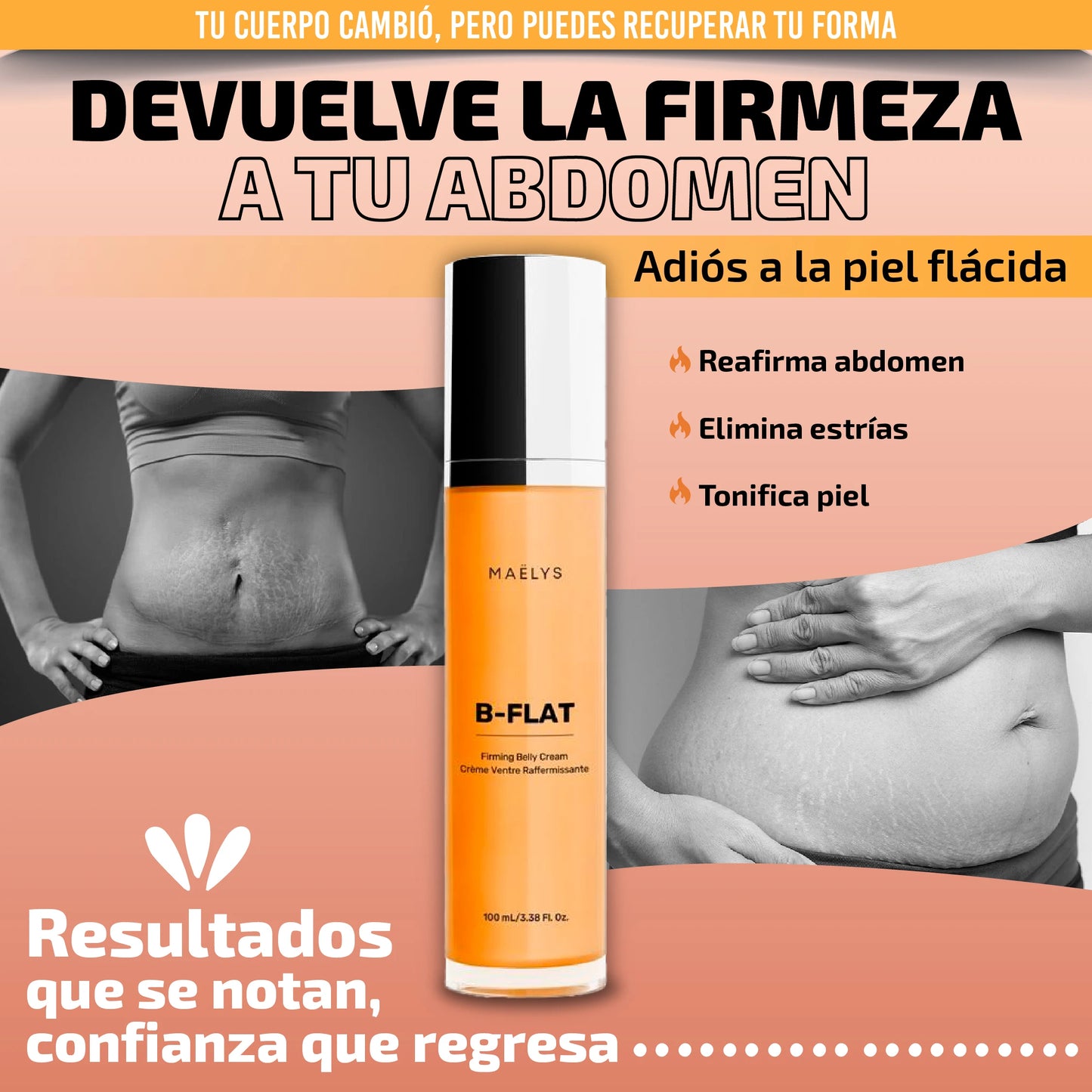 Tratamiento Intensivo Anti-Estrías y Flacidez