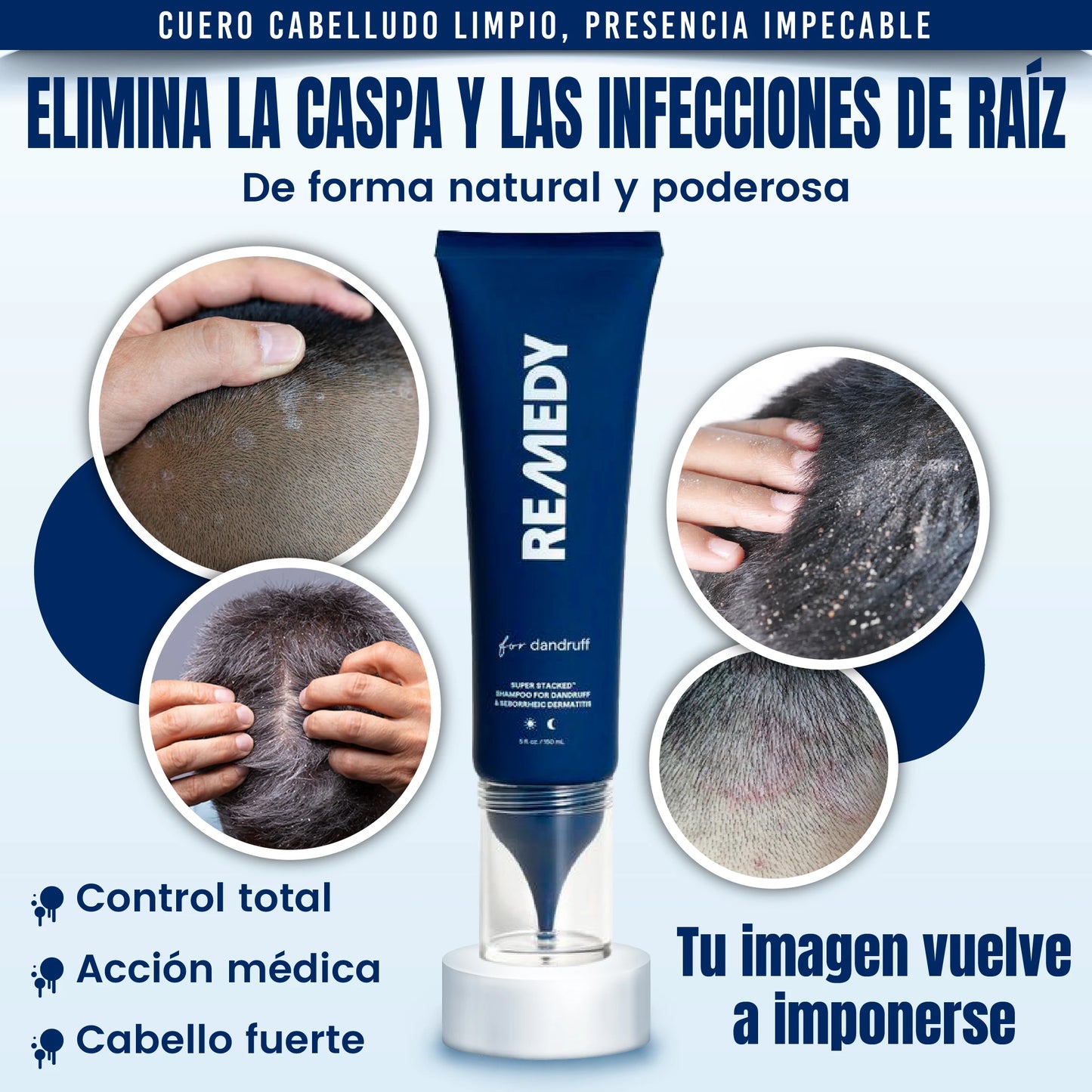 Tratamiento Capilar Médico Anti-Caspa e Infecciones