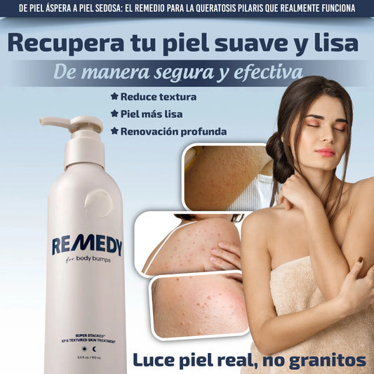 Crema corporal para eliminar la queratosis pilaris